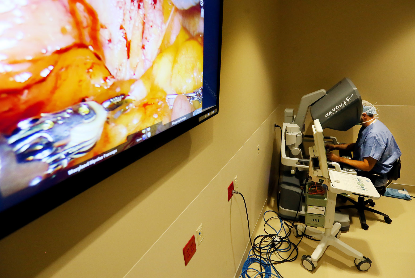 Robotic surgery 1